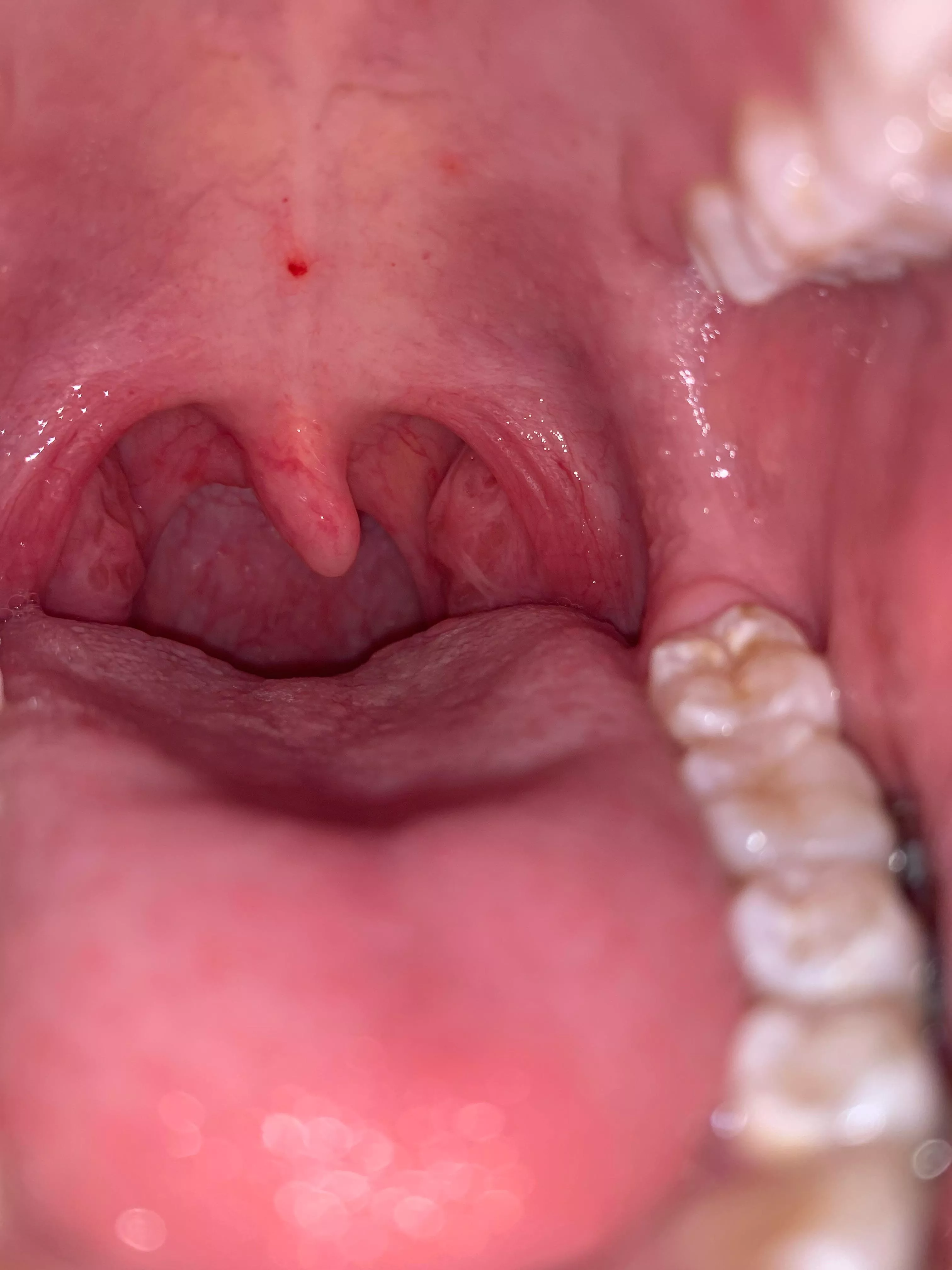 Something red in my mouth and it keeps moving