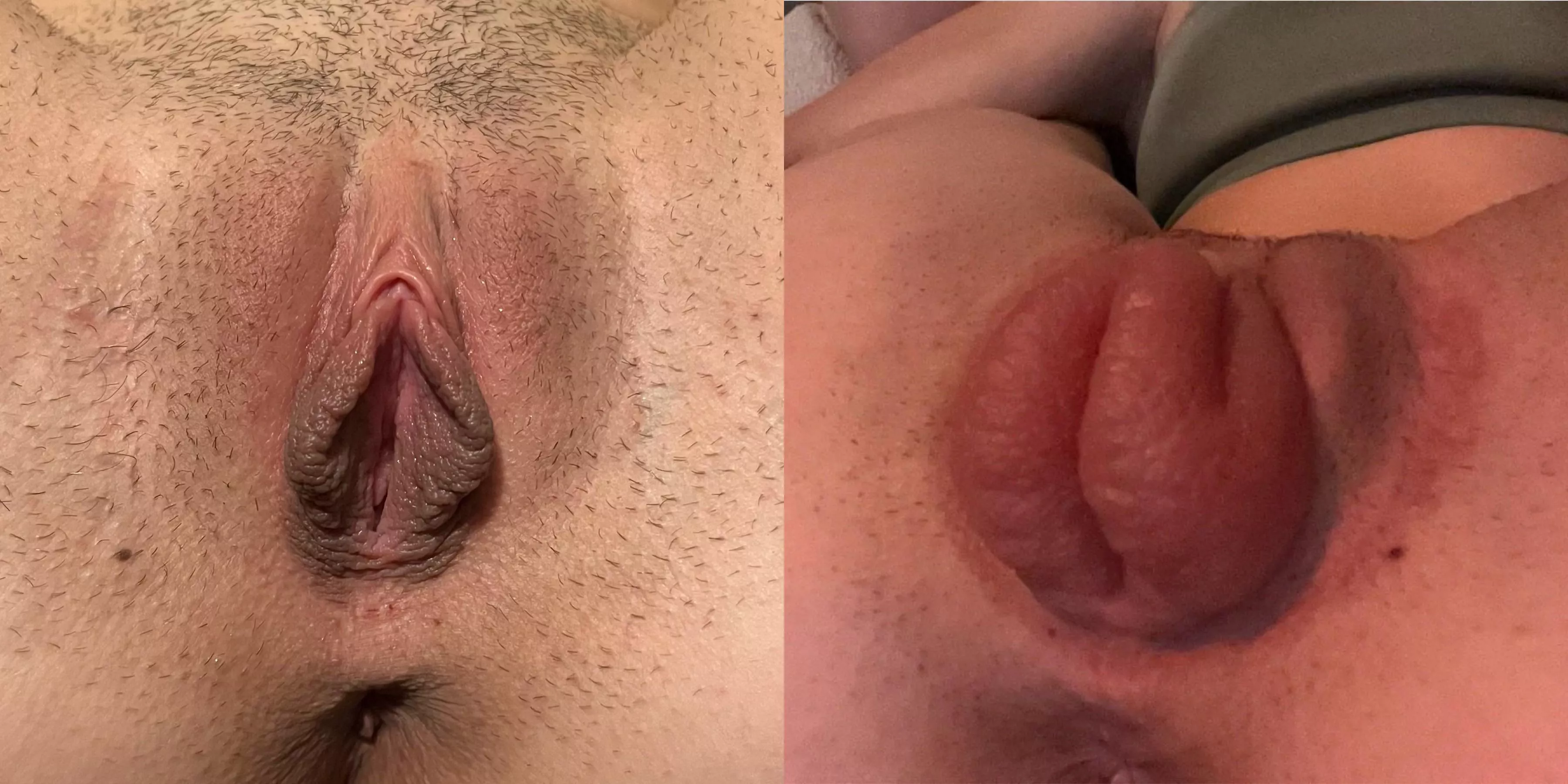 [f]Before and After