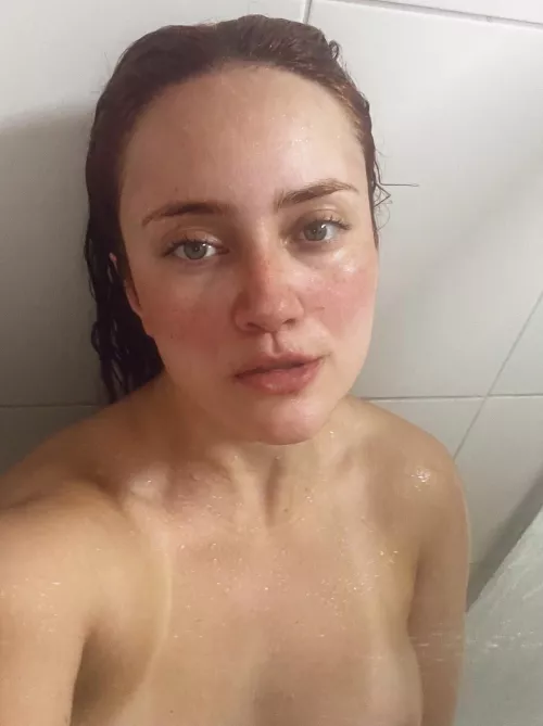 My eyes are up here. My freckles are everywhere. [IRTR]