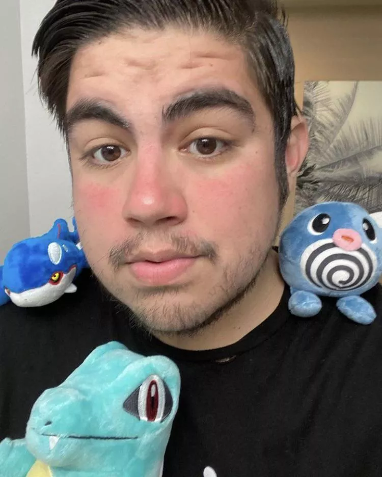 Sun Burnt Pokemon Trainer