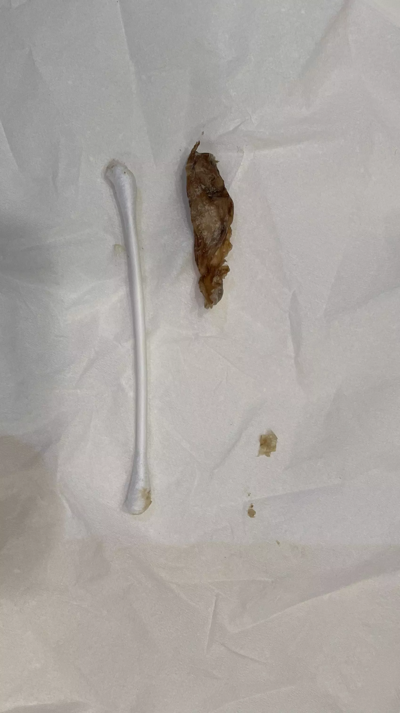 I have this taken out of my ear on a regular basis