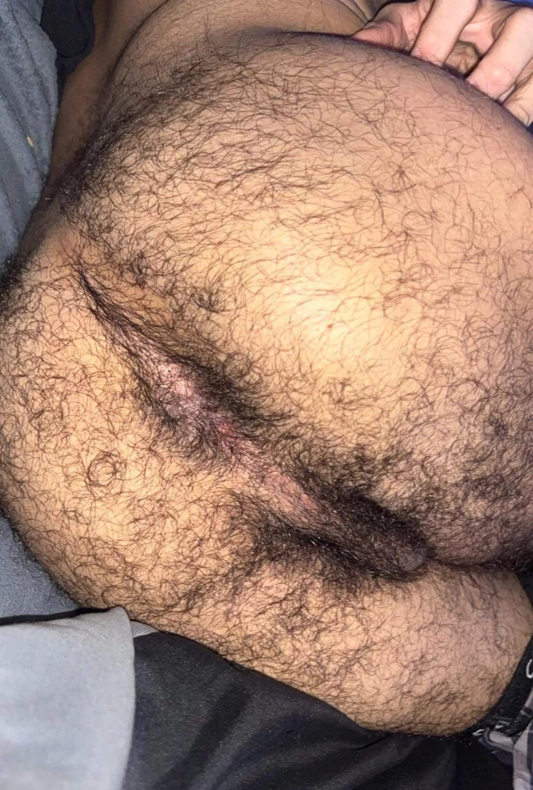 Am I too hairy for 19?