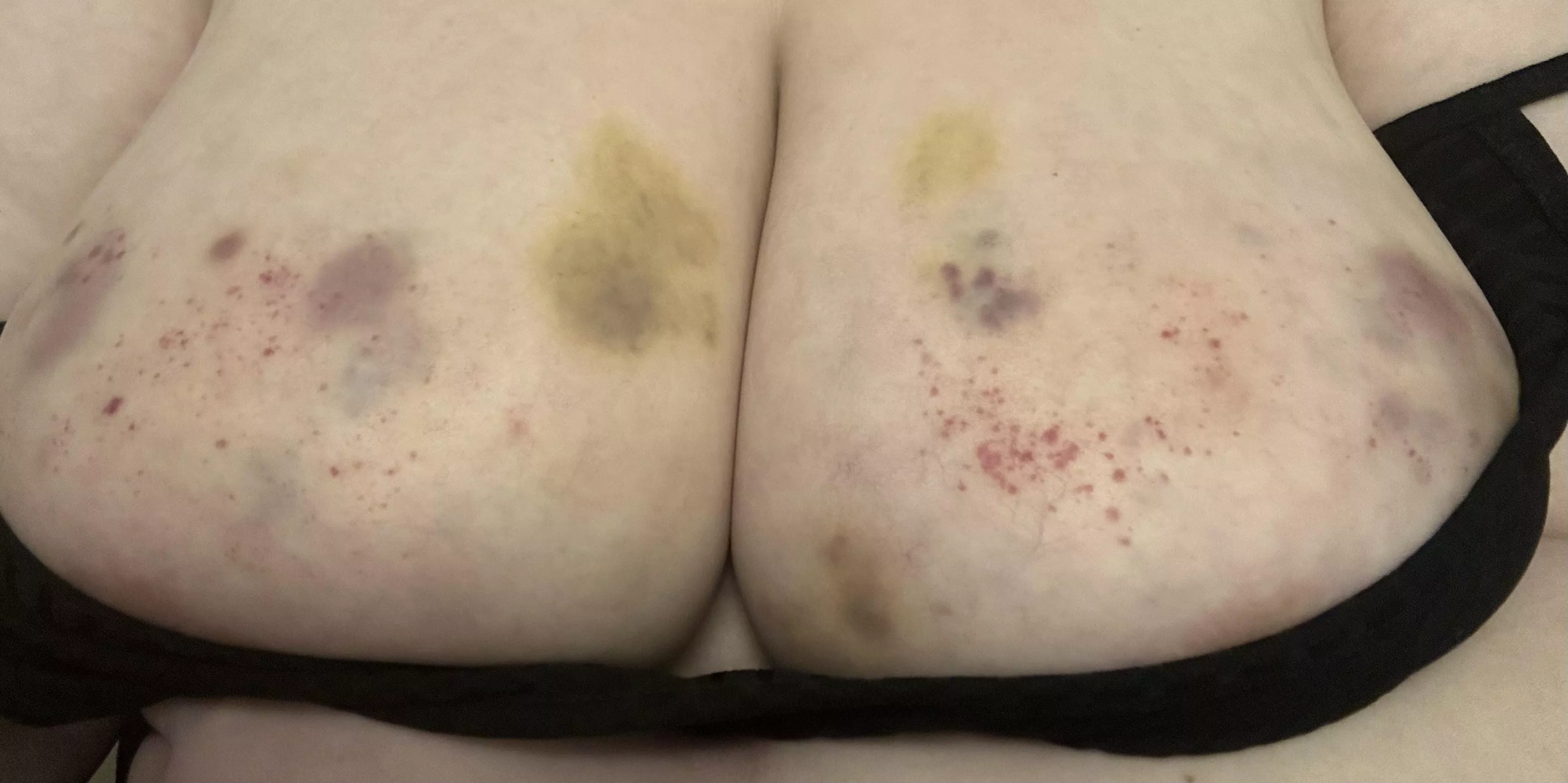 Beaten breasts are best