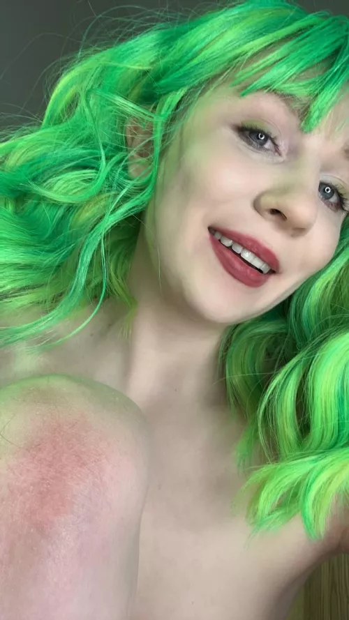 Rubbed knees after a hot night out