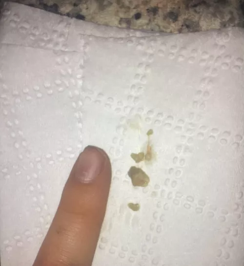 This one was from a few years ago. Biggest one I’ve ever had.