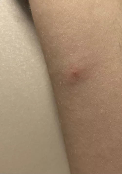 woke up with this, what could this be?
