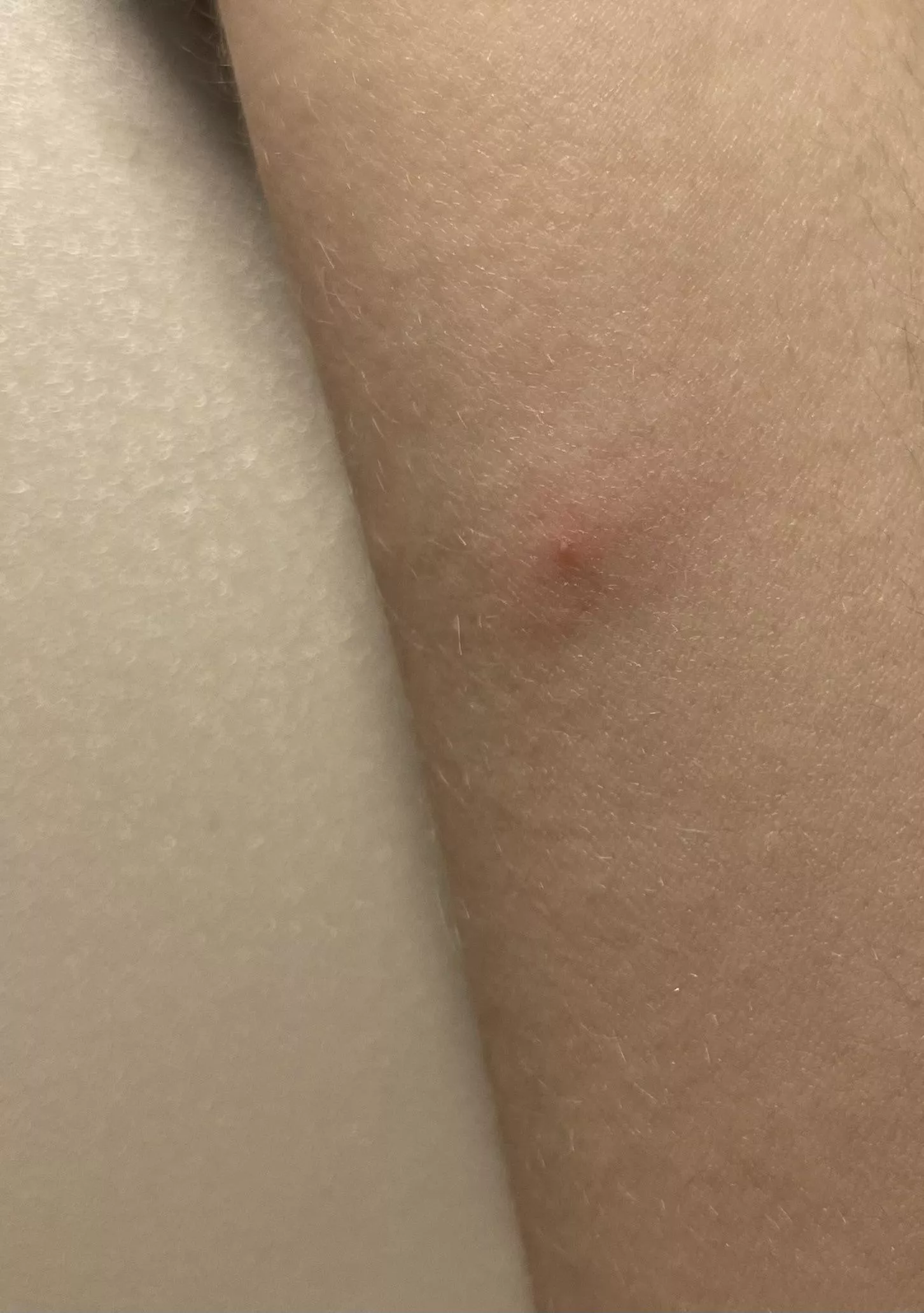 woke up with this, what could this be?