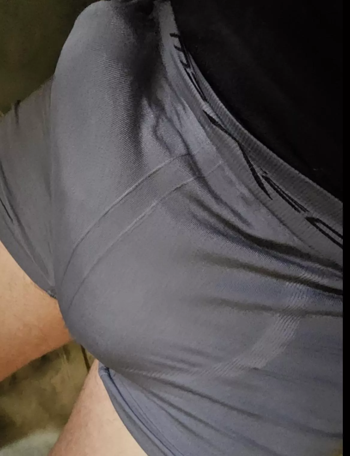 Felt bulgey today