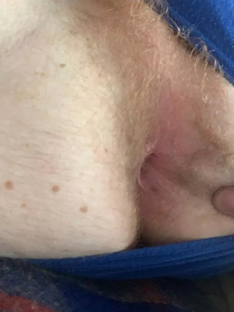 Fill this ginger hole
