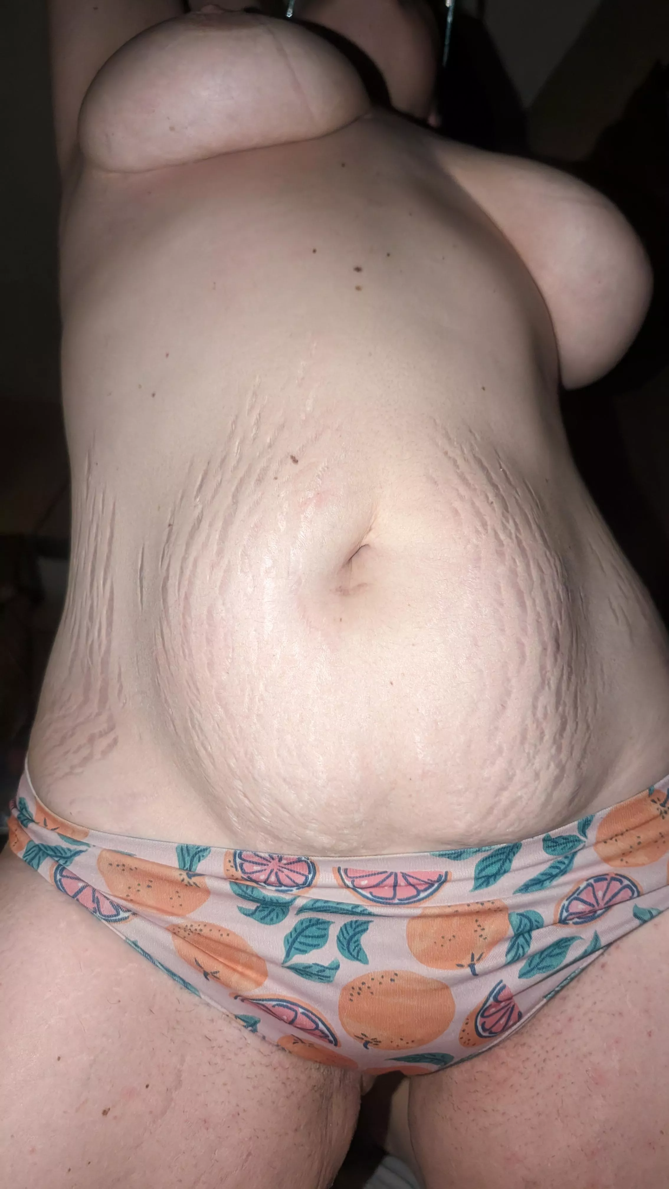 I hope you don't mind a tiger stripes and hail dents on my 38yo mombod