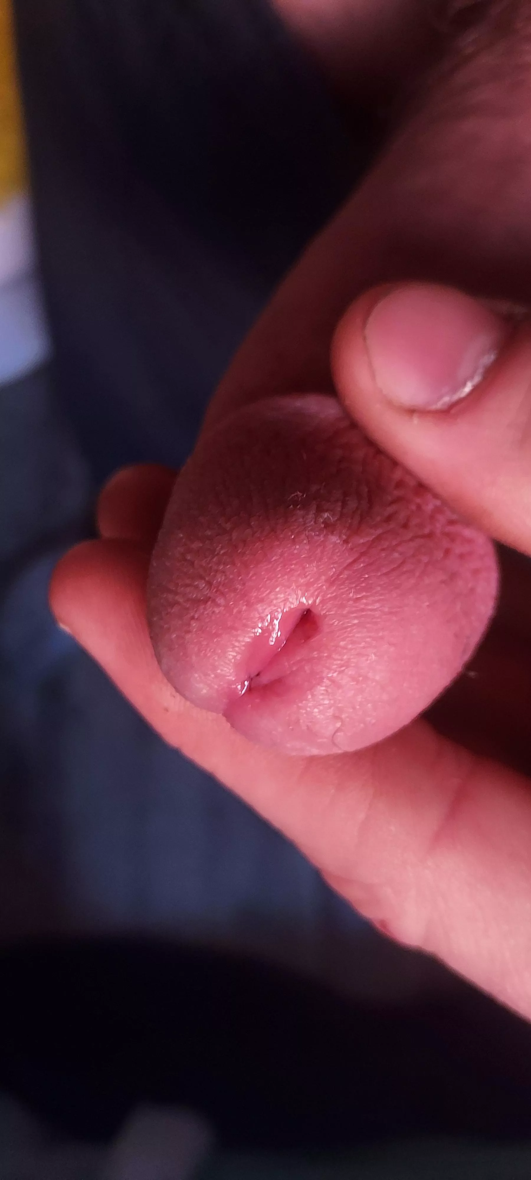 Starting to leak