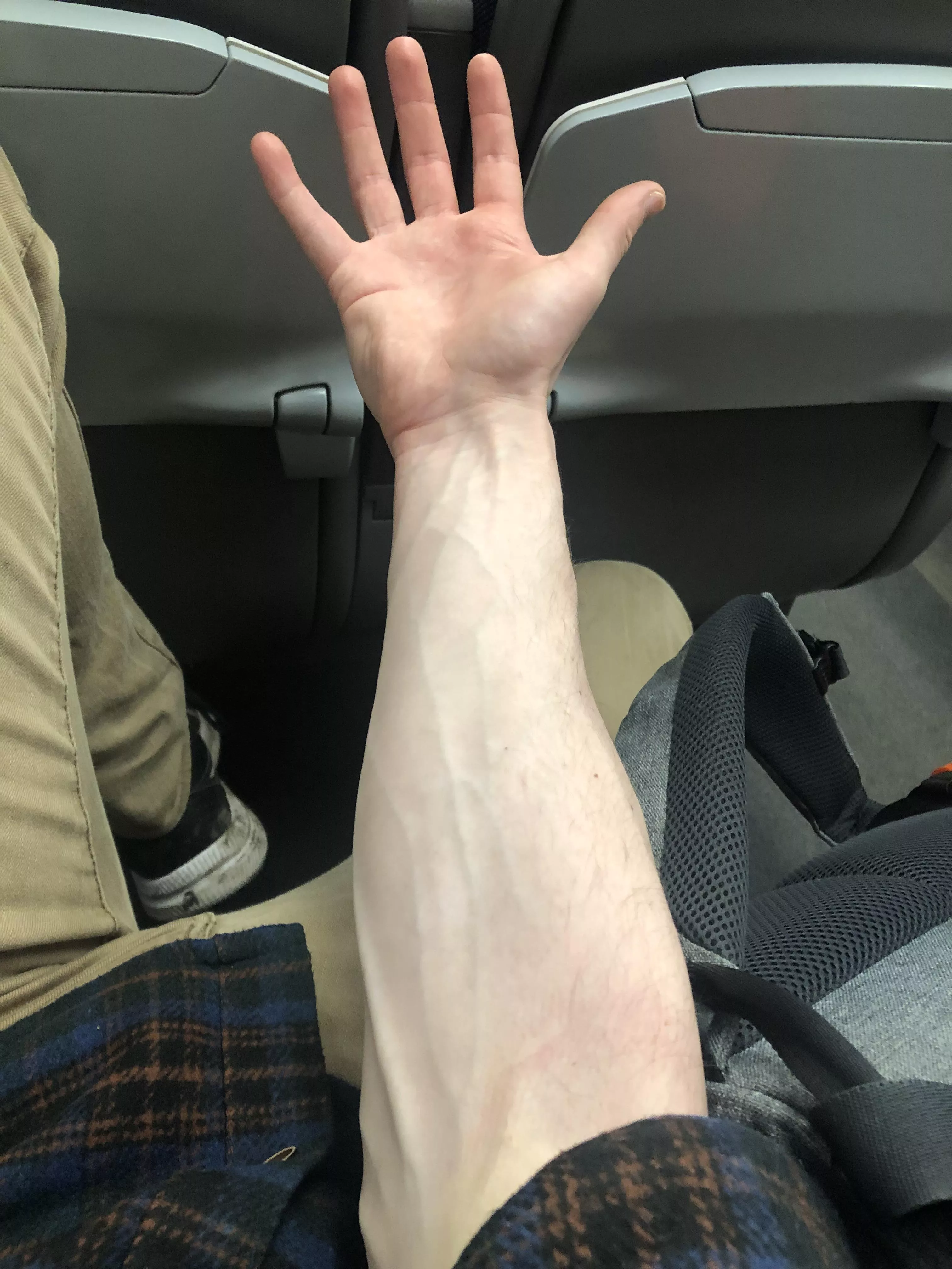 Veins on a train