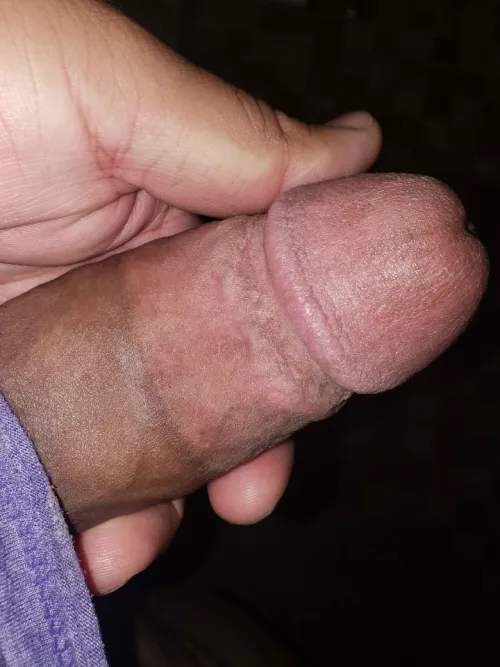 Anyone a fan of promenant scars? (28)