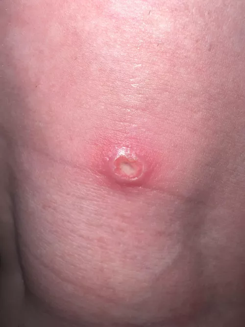 What could this be? On my mothers leg