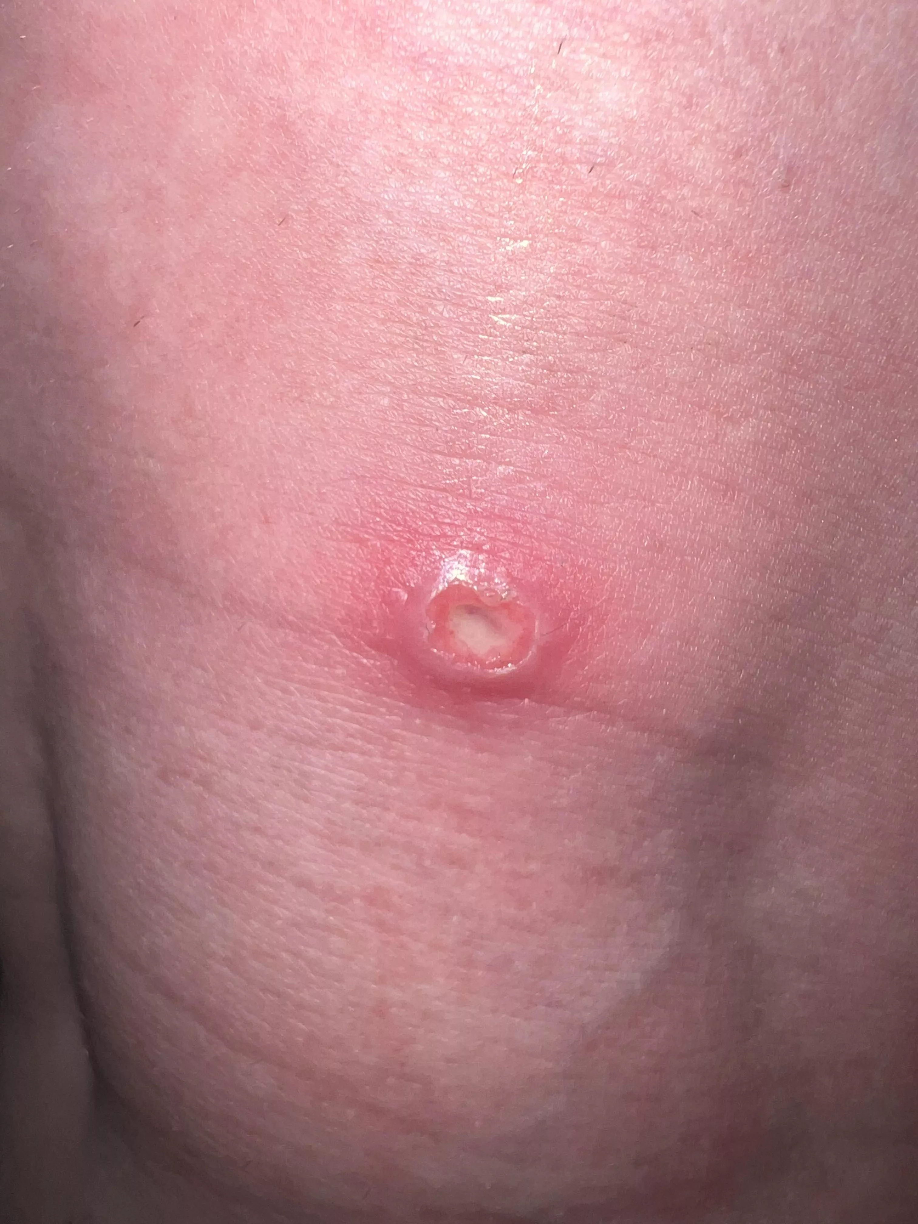 What could this be? On my mothers leg