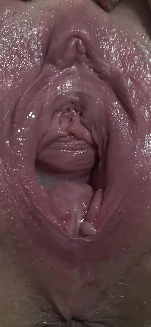 After fisting and clit pump