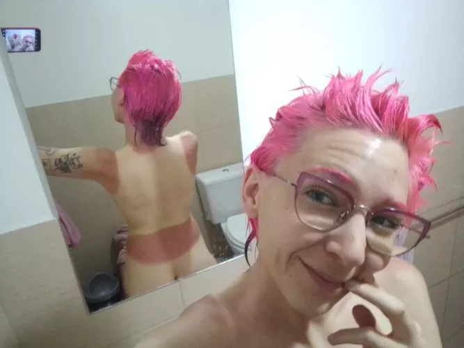 After getting sunburned, my body matches my hair