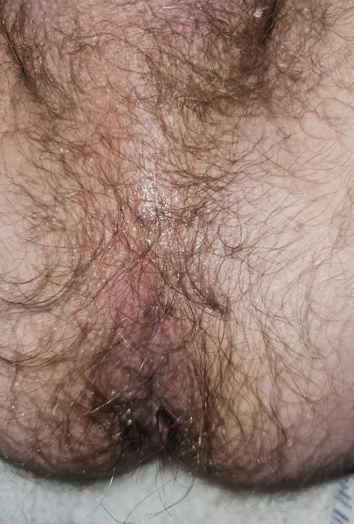 My hairy hole