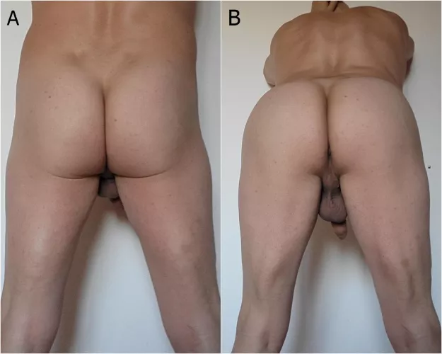 How should I present myself for you? A or B