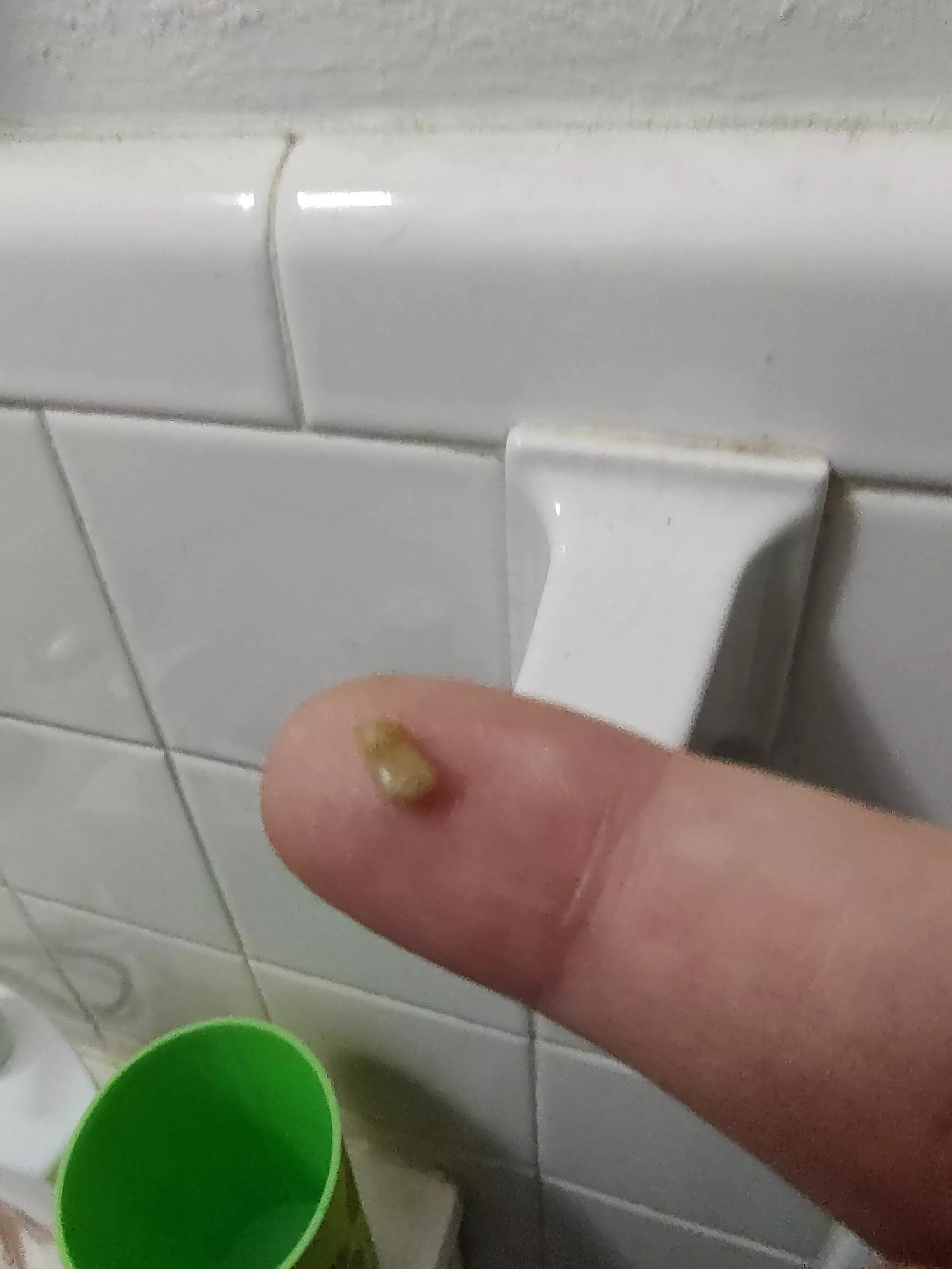 Woke up coughing up this bad boy