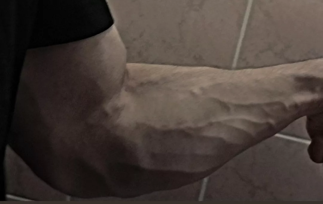 Does anybody like this much of veins in forearms