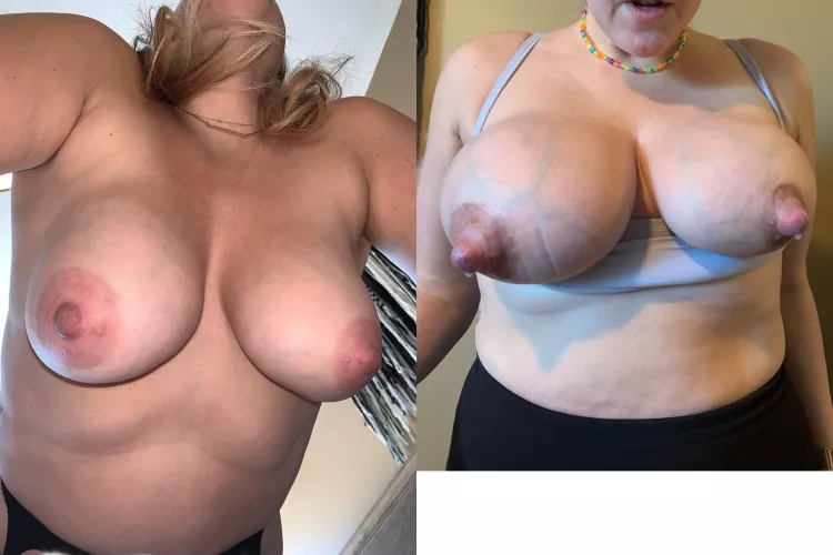 My Normal boobs VS my Engorged milk filled boobs