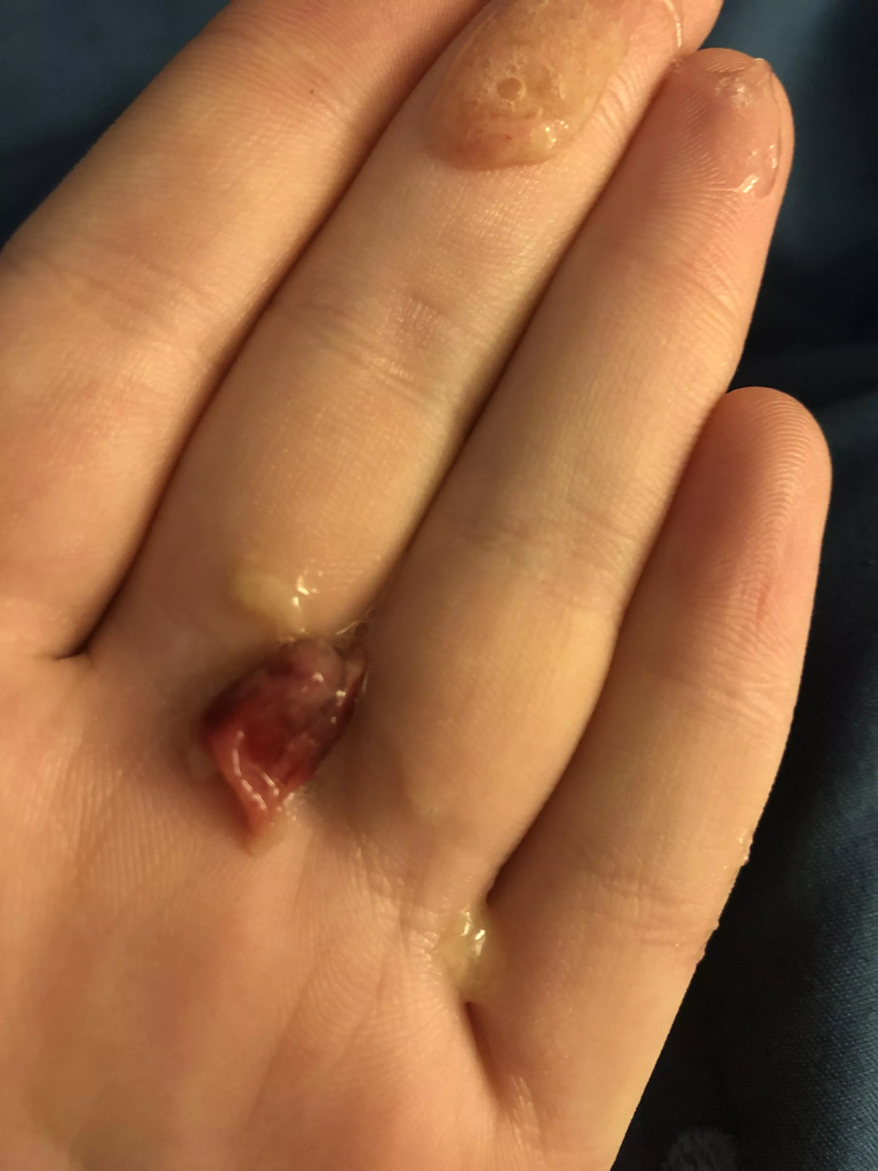 Coughed this up dunno what it is (GROSS)
