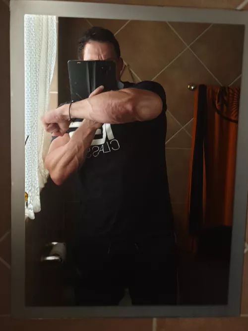 I tried to catch the road map of veins on my forearm, you can still see some of it