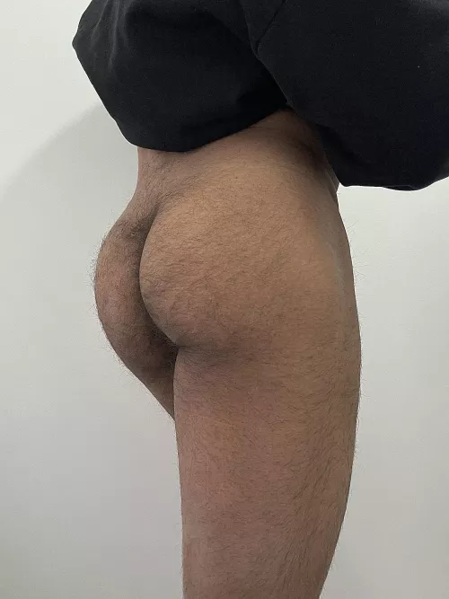 Is it too hairy? (23)