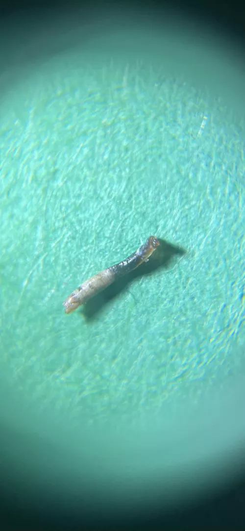 What did I just pick out of my face!? (30x magnified)