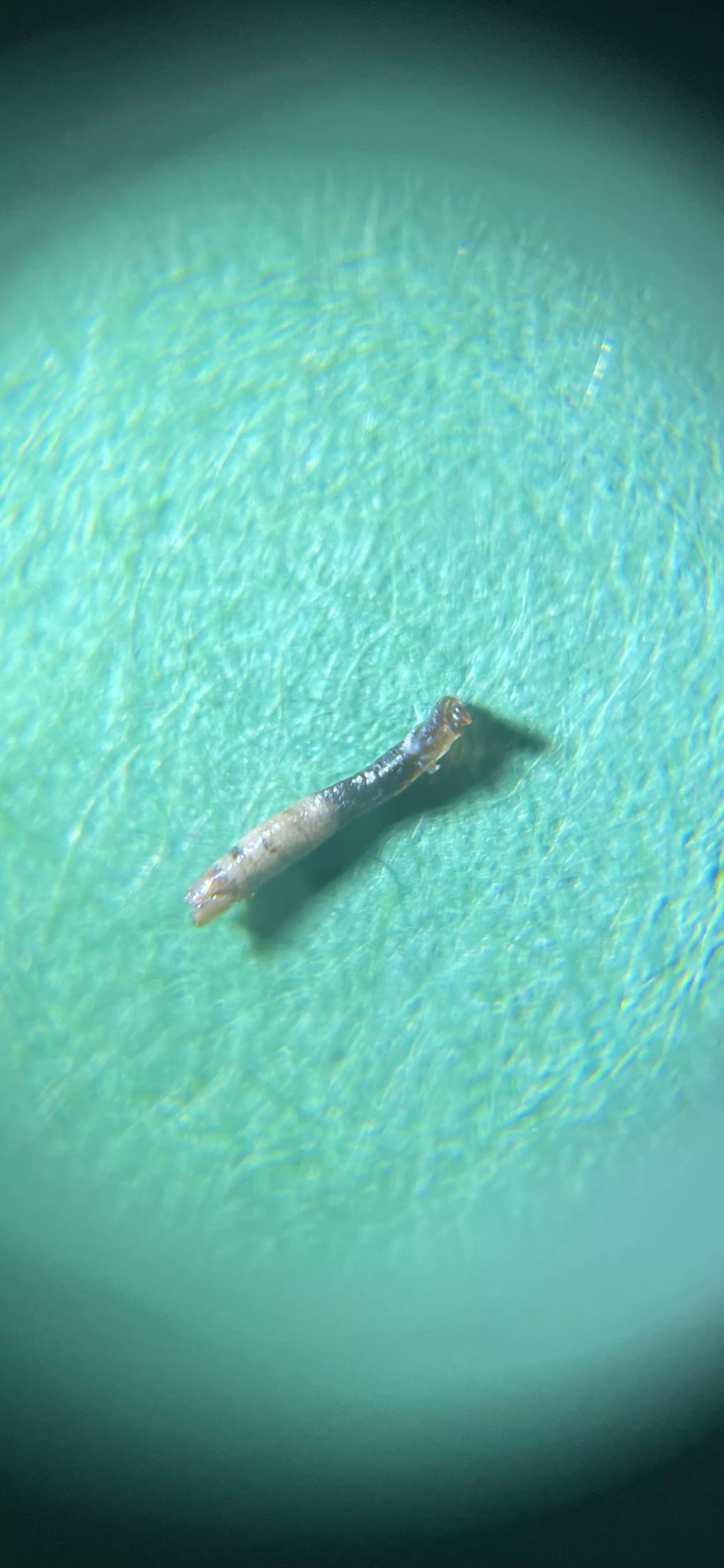 What did I just pick out of my face!? (30x magnified)