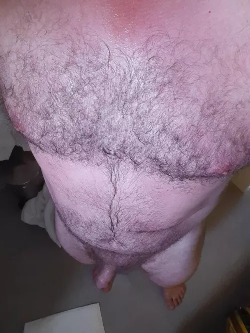 (39) a little sunburn