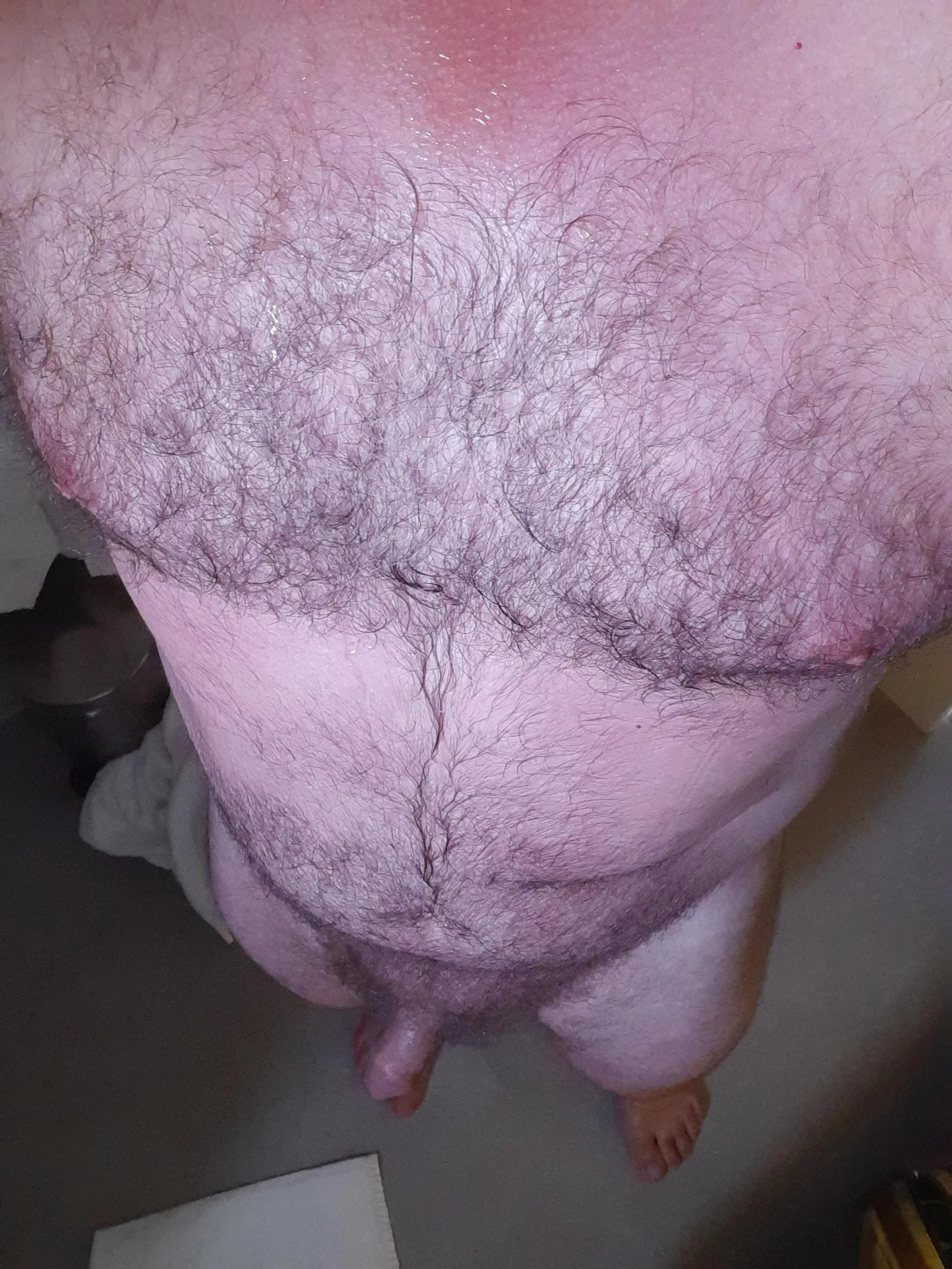 (39) a little sunburn