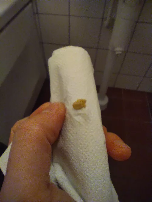 A gift from my tonsils