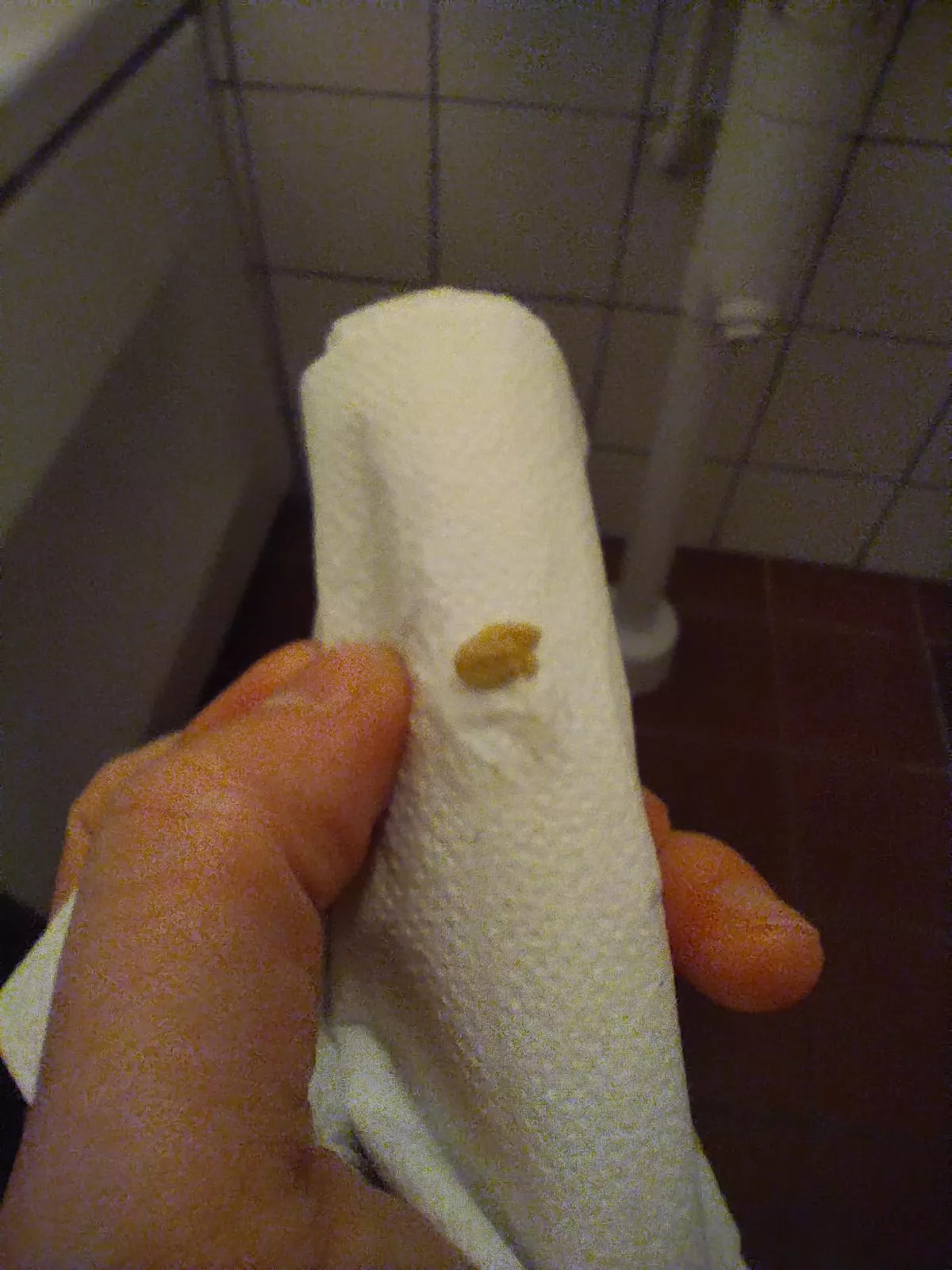 A gift from my tonsils