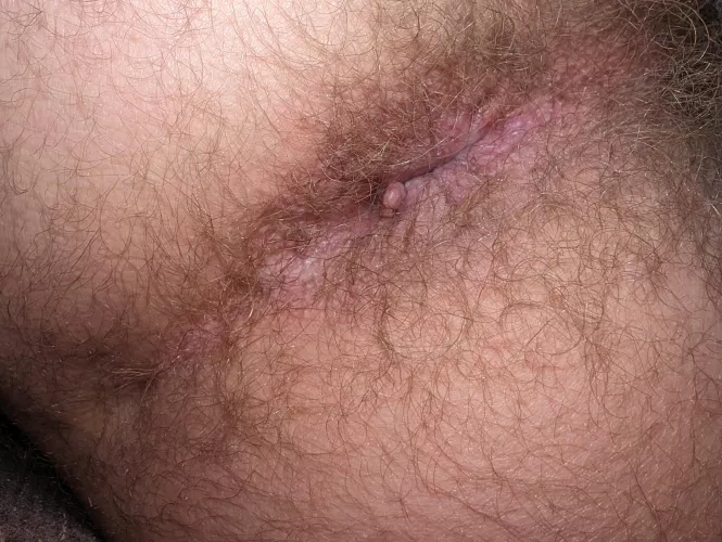 Hairy enough to eat?