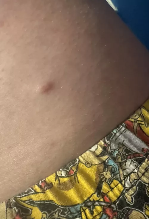 Has anyone else had something similar?