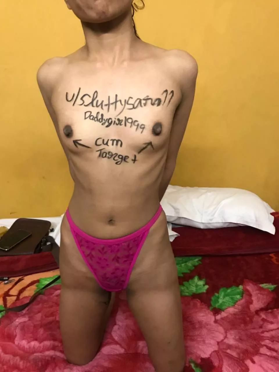 Is your target fixed