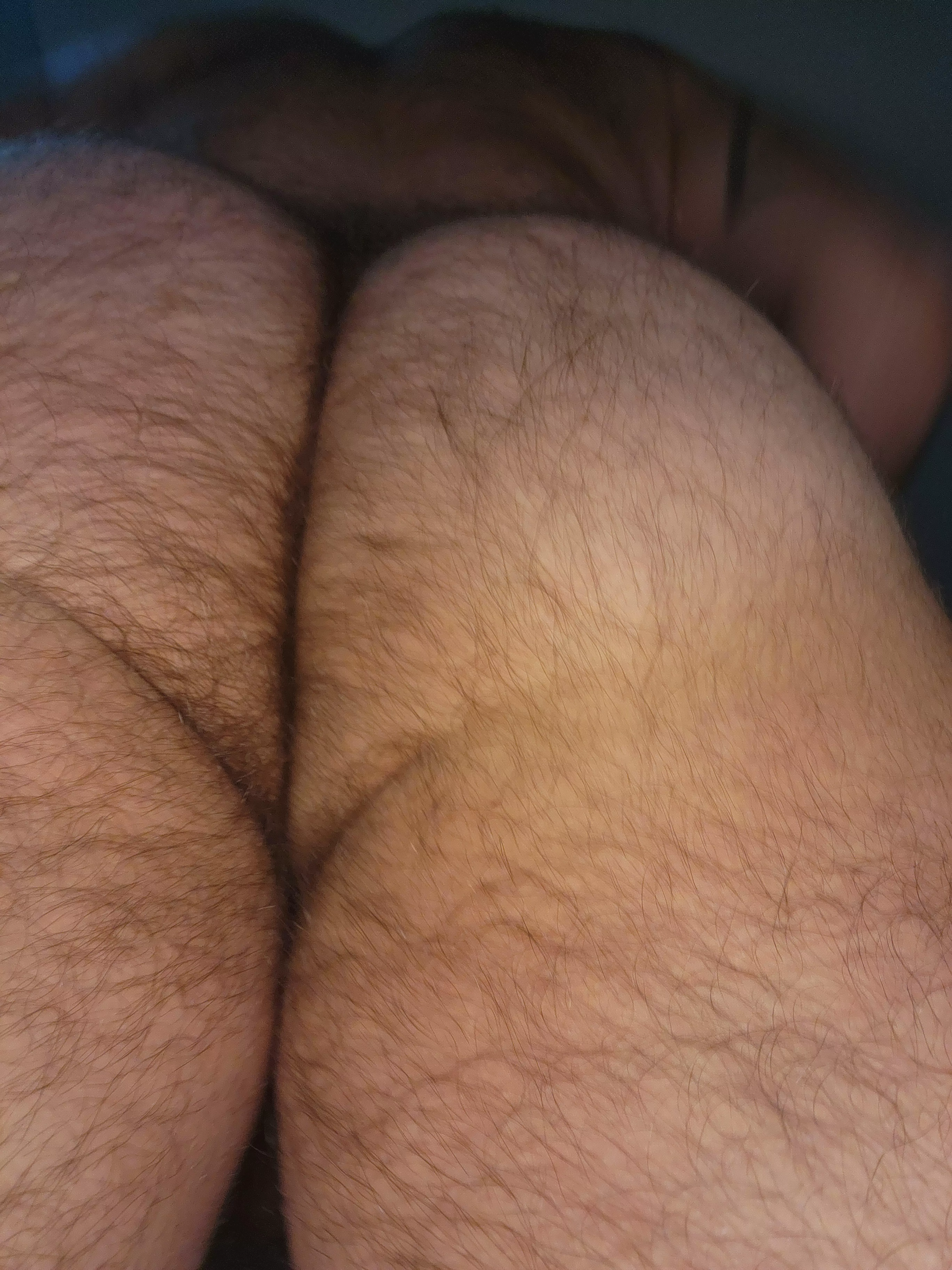 Who likes a hairy man ass?