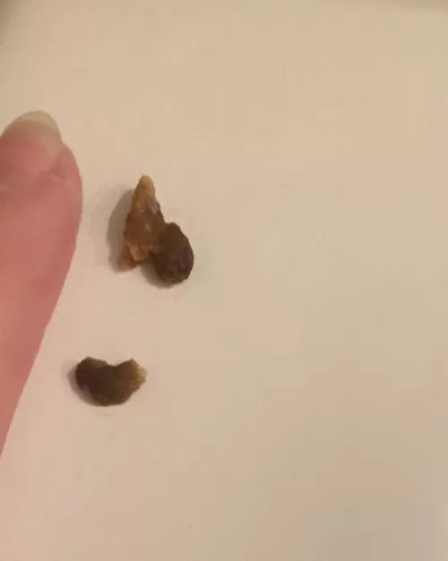 flushed these out of both ears. the world has never sounded so crisp in my life.