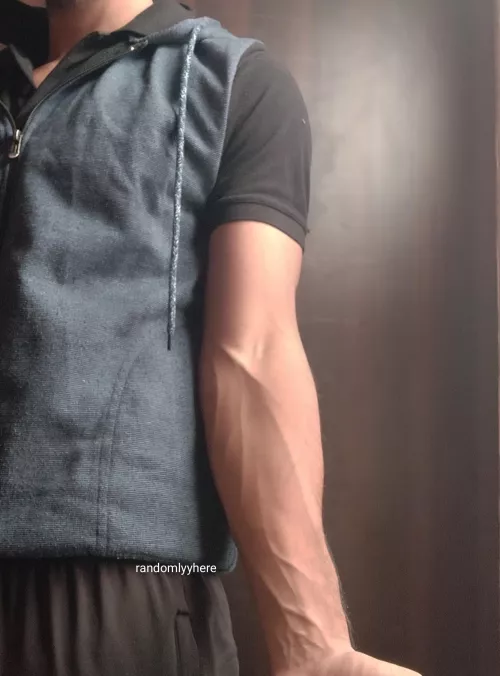veins ;)