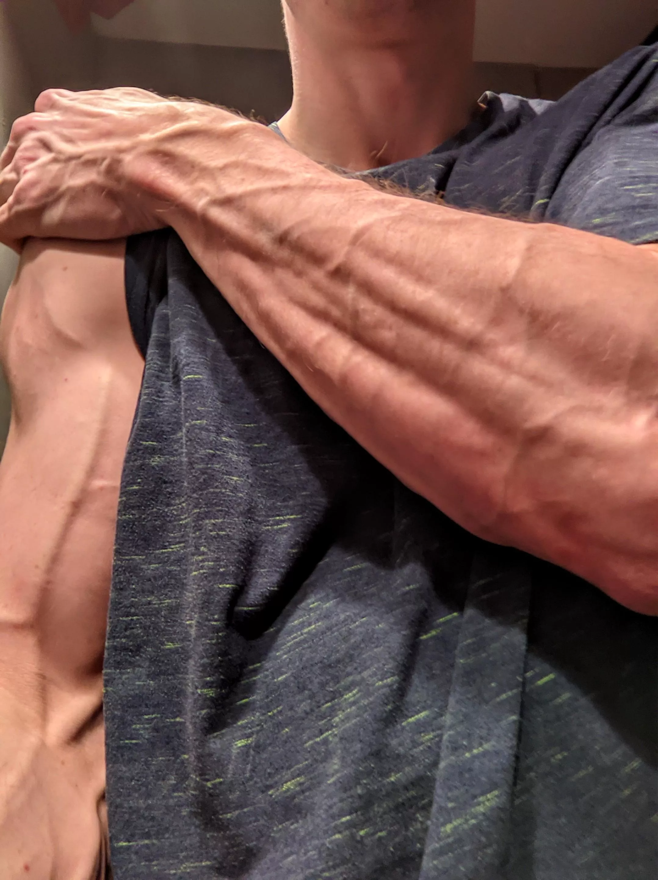 What is it about veins?