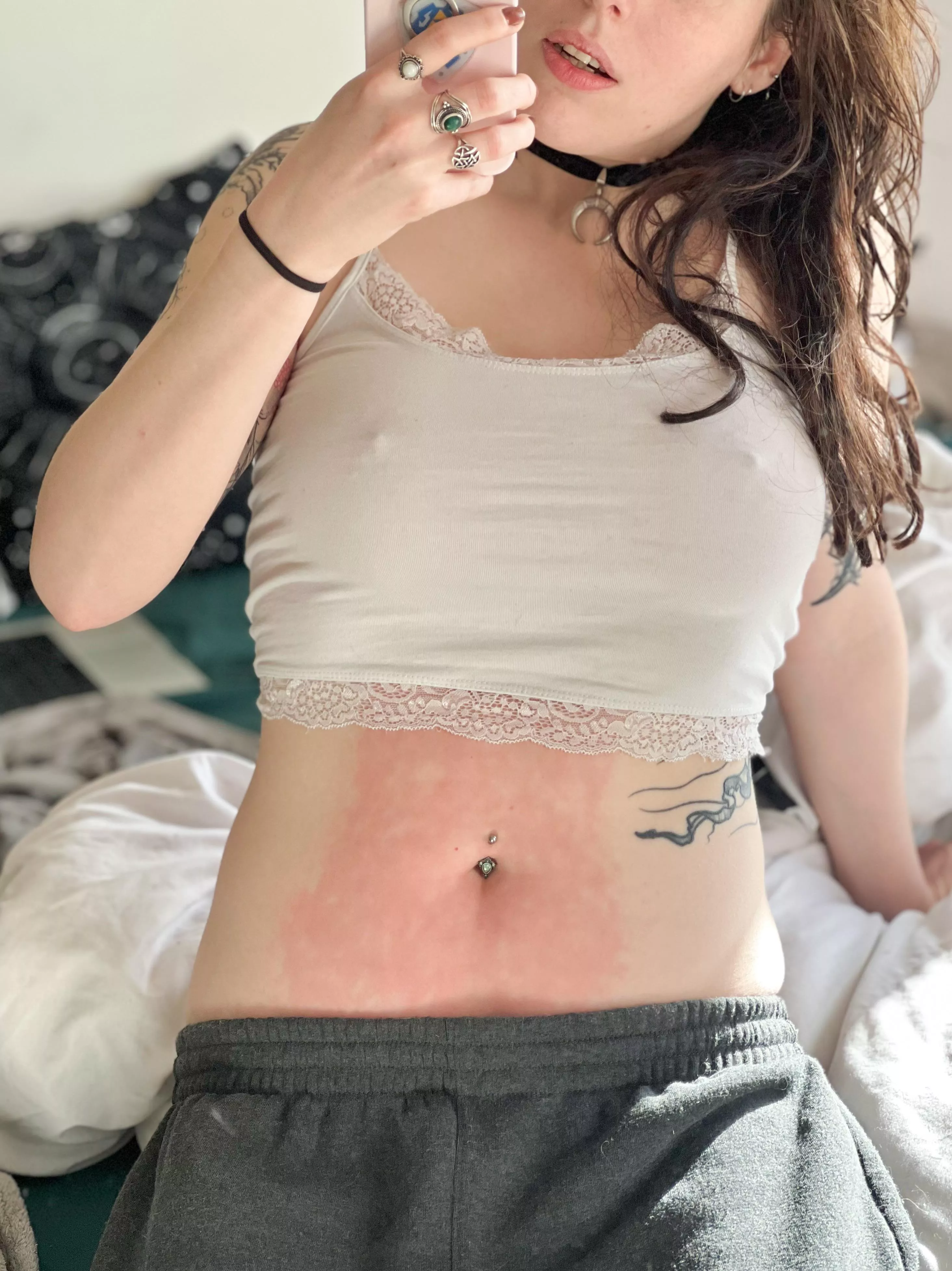 Lazy Sunday featuring hot water bottle burn marks