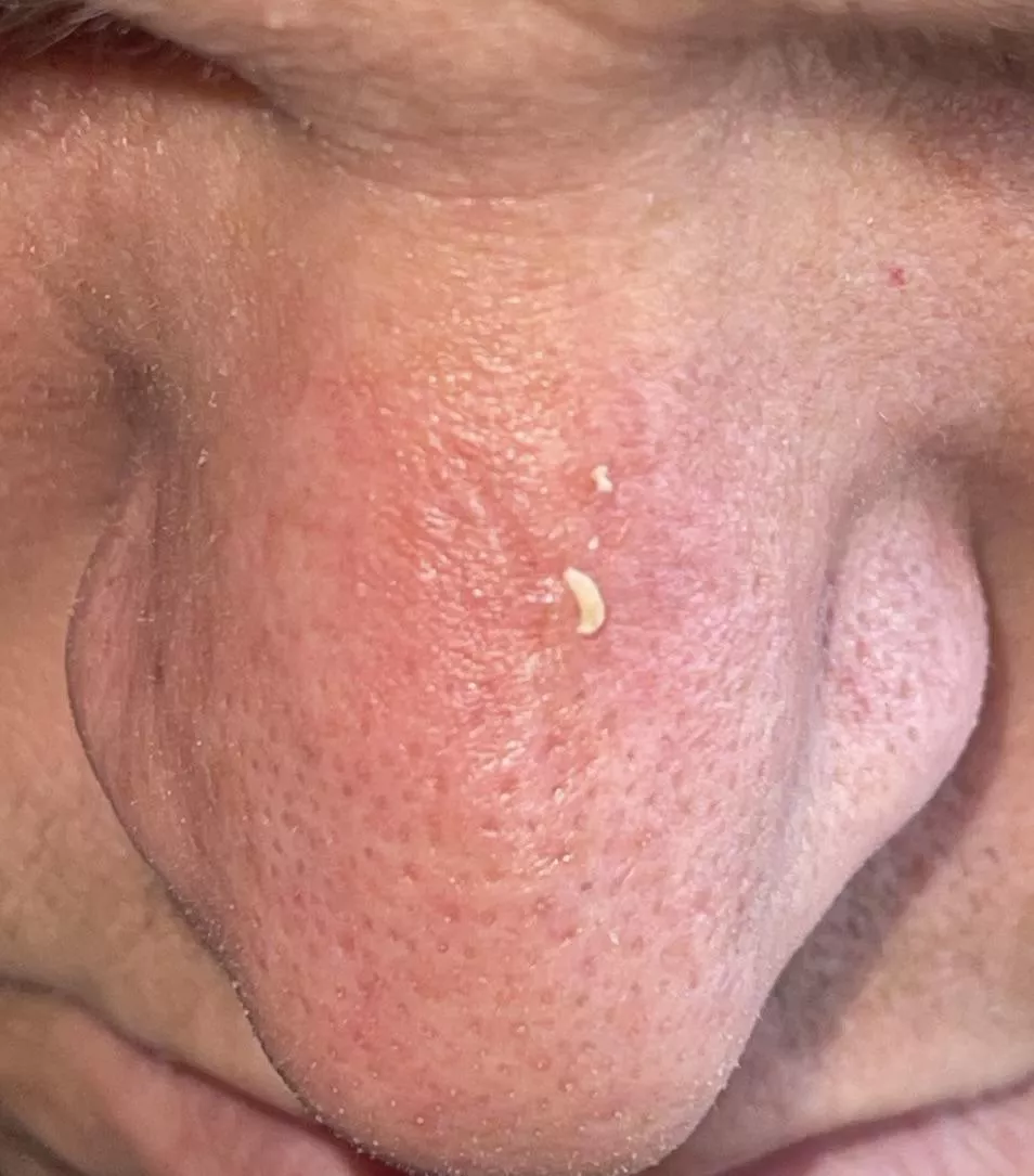 My husband’s nose is a gold mine