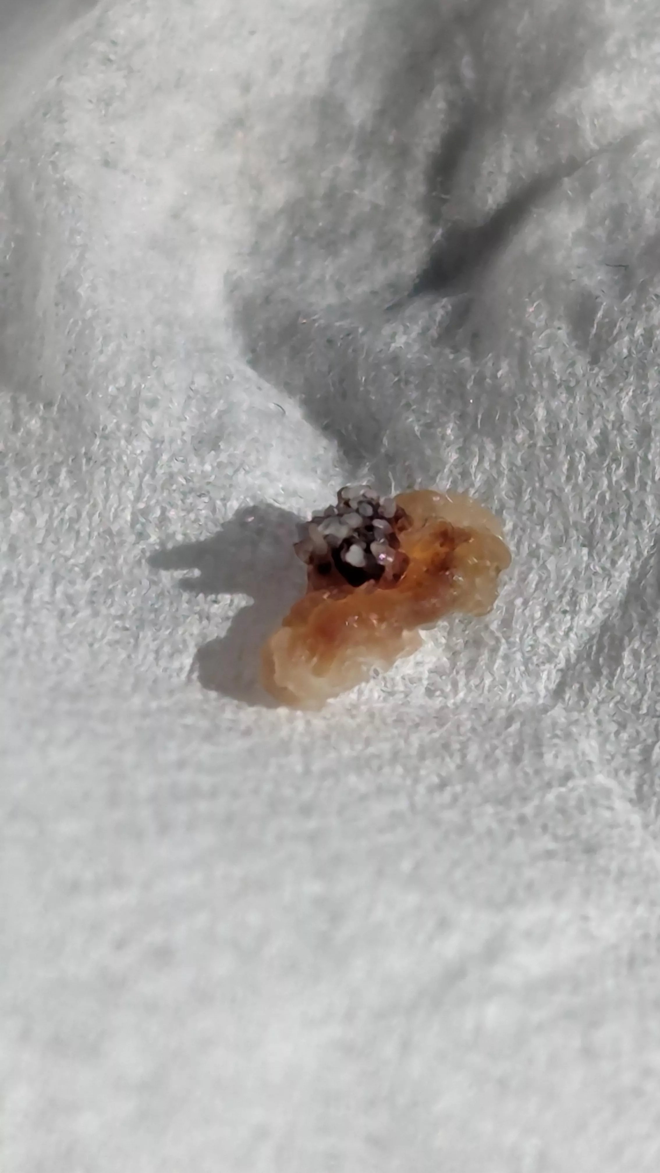 This wart that fell off my face after being frozen looks like a Nudibranch