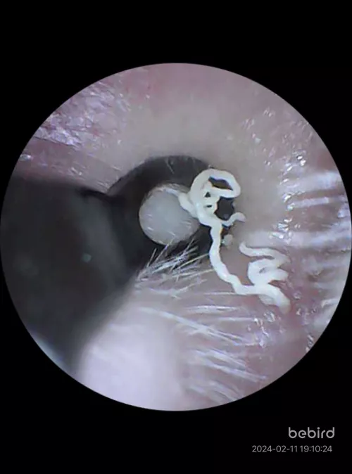 Ear blackhead that pops every so often