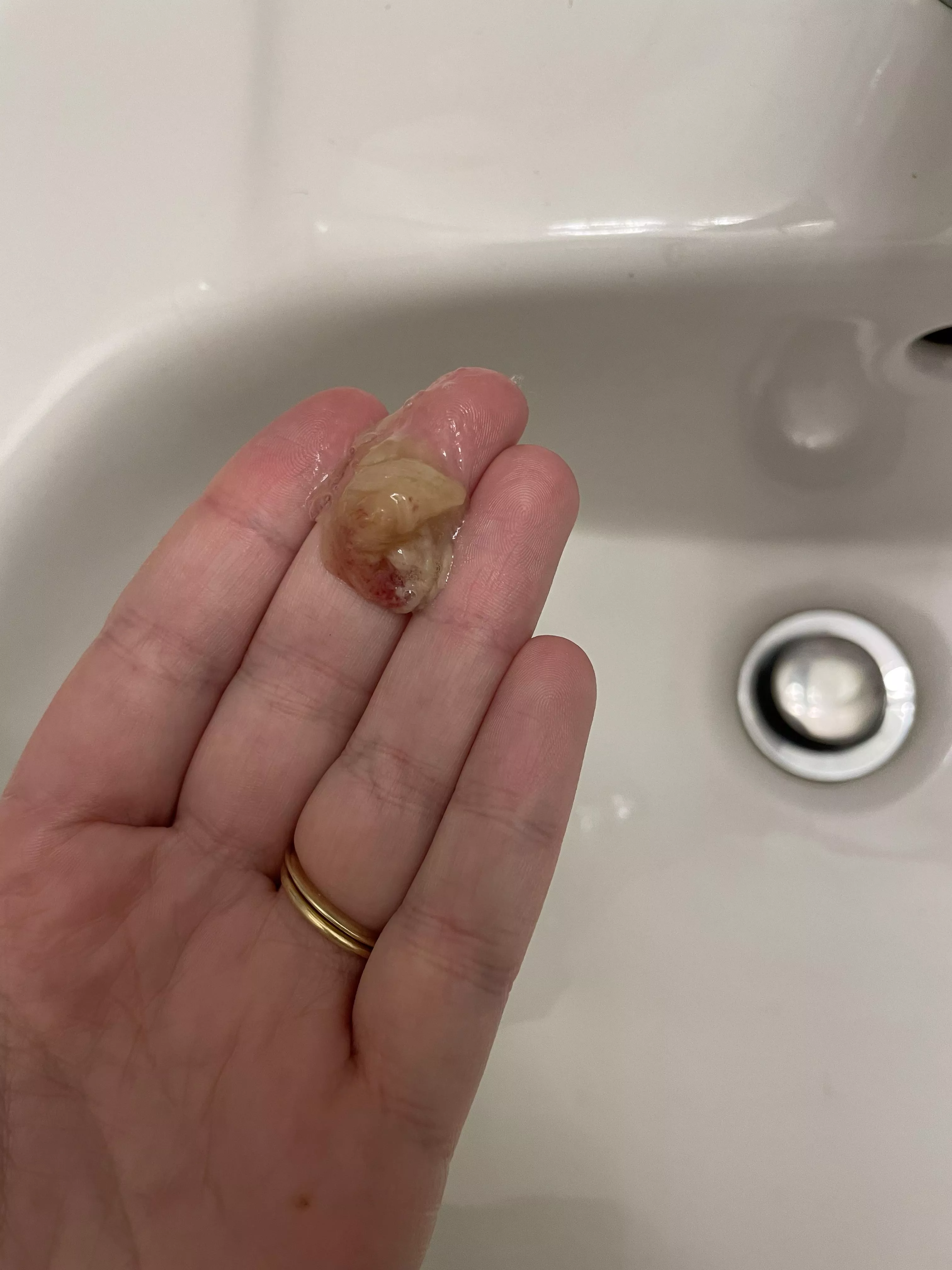 Felt this come out - dealing with strep throat