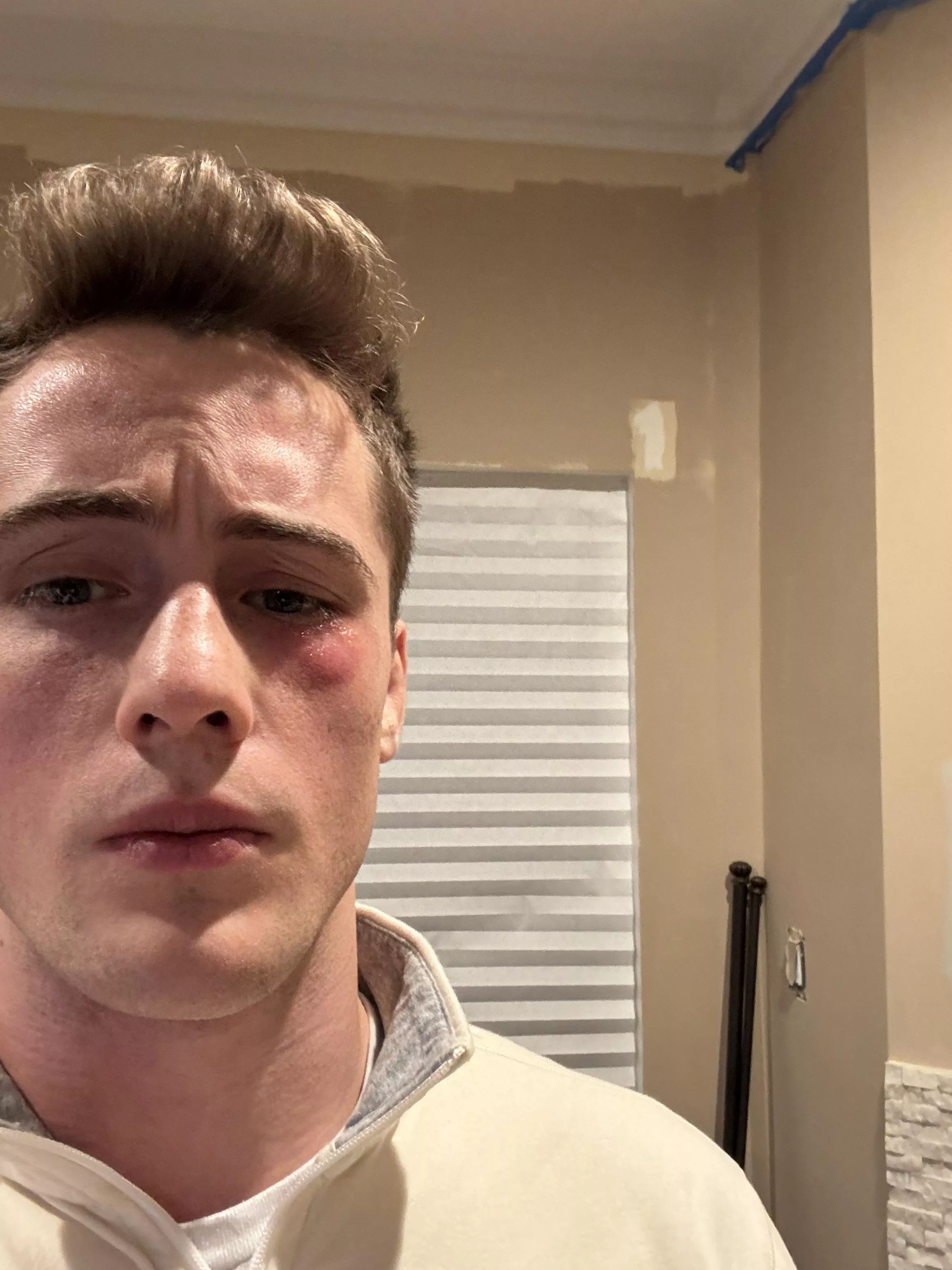 Got staph from wrestling practice so no date for me on Valentine’s Day😂 Got staph from wrestling practice so no date for me on Valentine’s Day😂