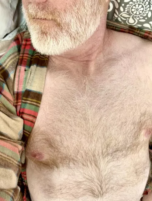 I hope you like fuzzy gingers.