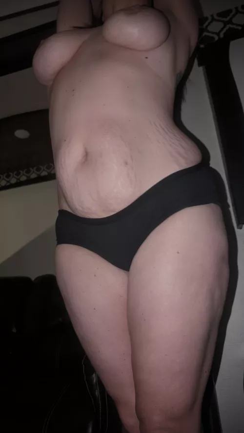 I hope you don't mind a few tiger stripes and hail dents on my mommy body, my husbands friends don't 